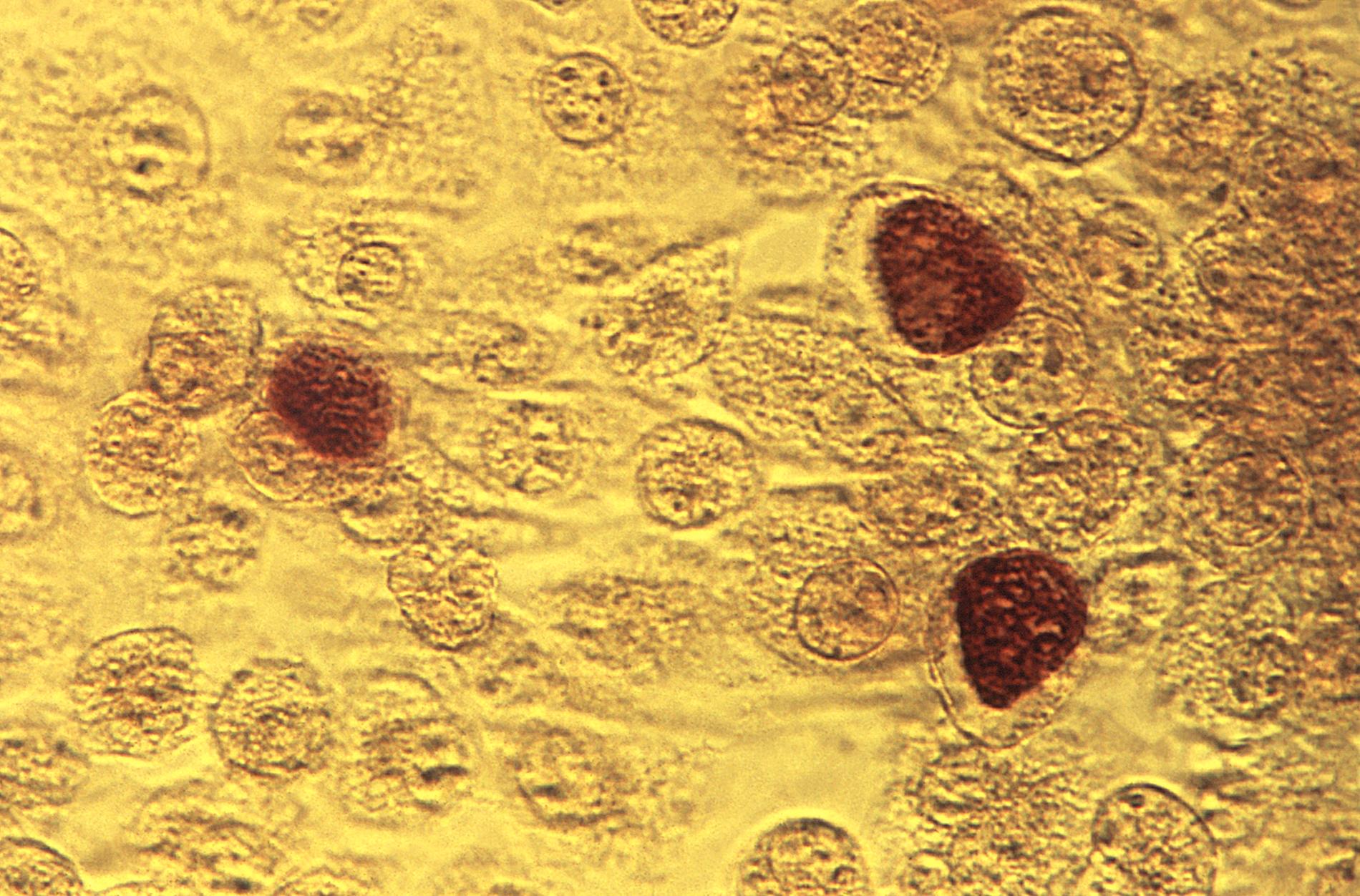 En klamydiabakterie uppförstorad 200 gånger, sedd genom ett mikroskop 1975. Bilden är tagen av den amerikanska folkhälsomyndigheten, Centers for disease control and prevention.