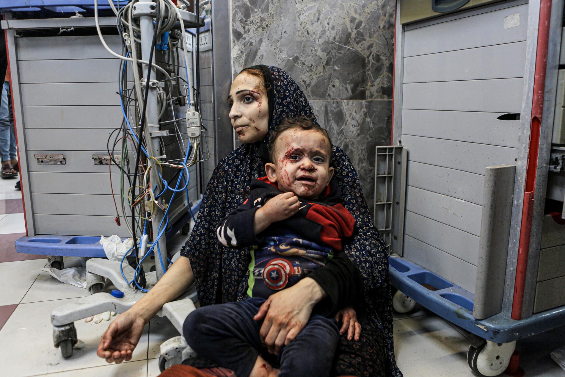 En skadad kvinna med sitt barn får vård på al-shifa sjukhuset i Gaza. Arkivbild från 17 oktober. 