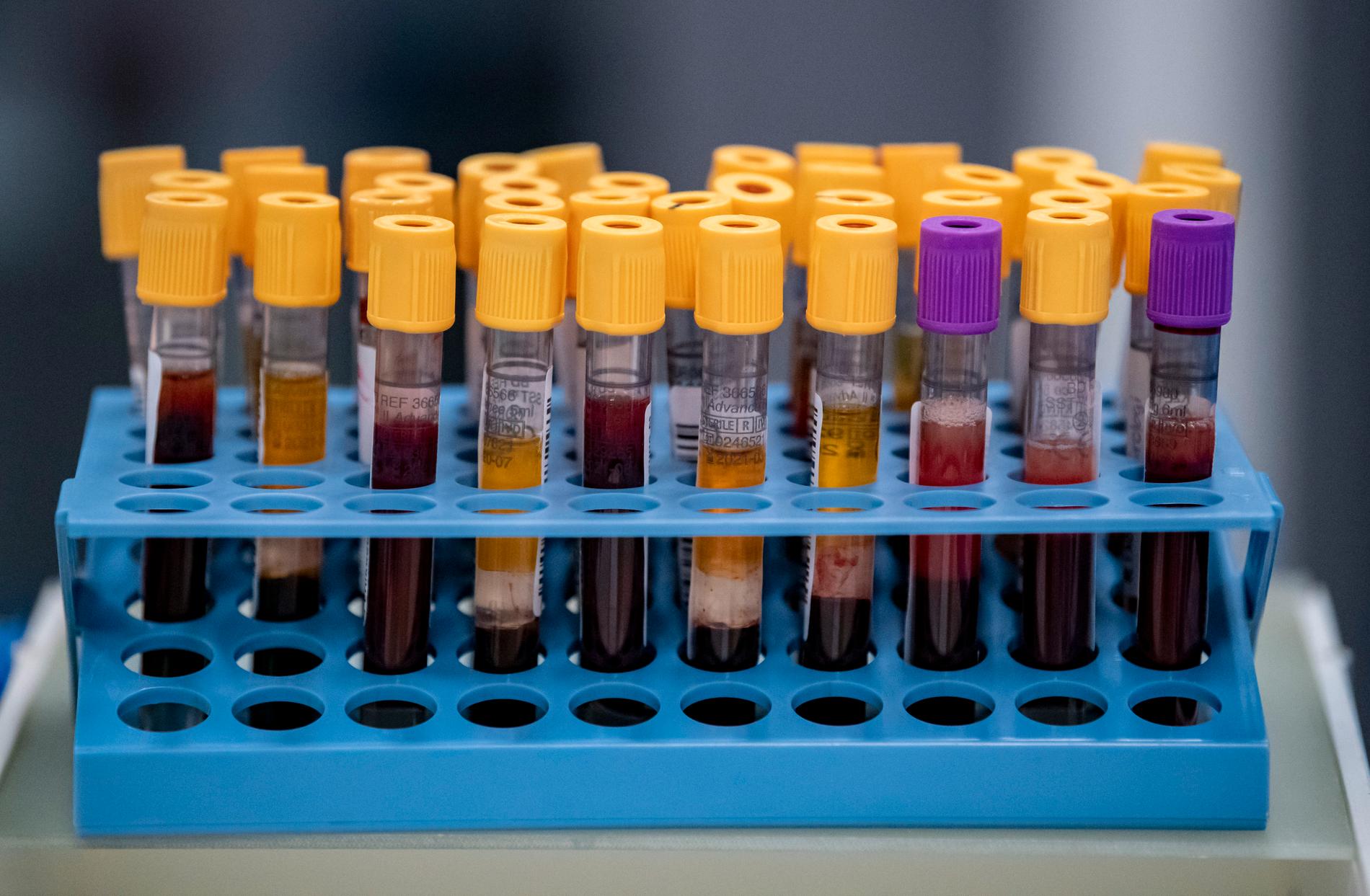 Blodprover analyseras för antikroppar.