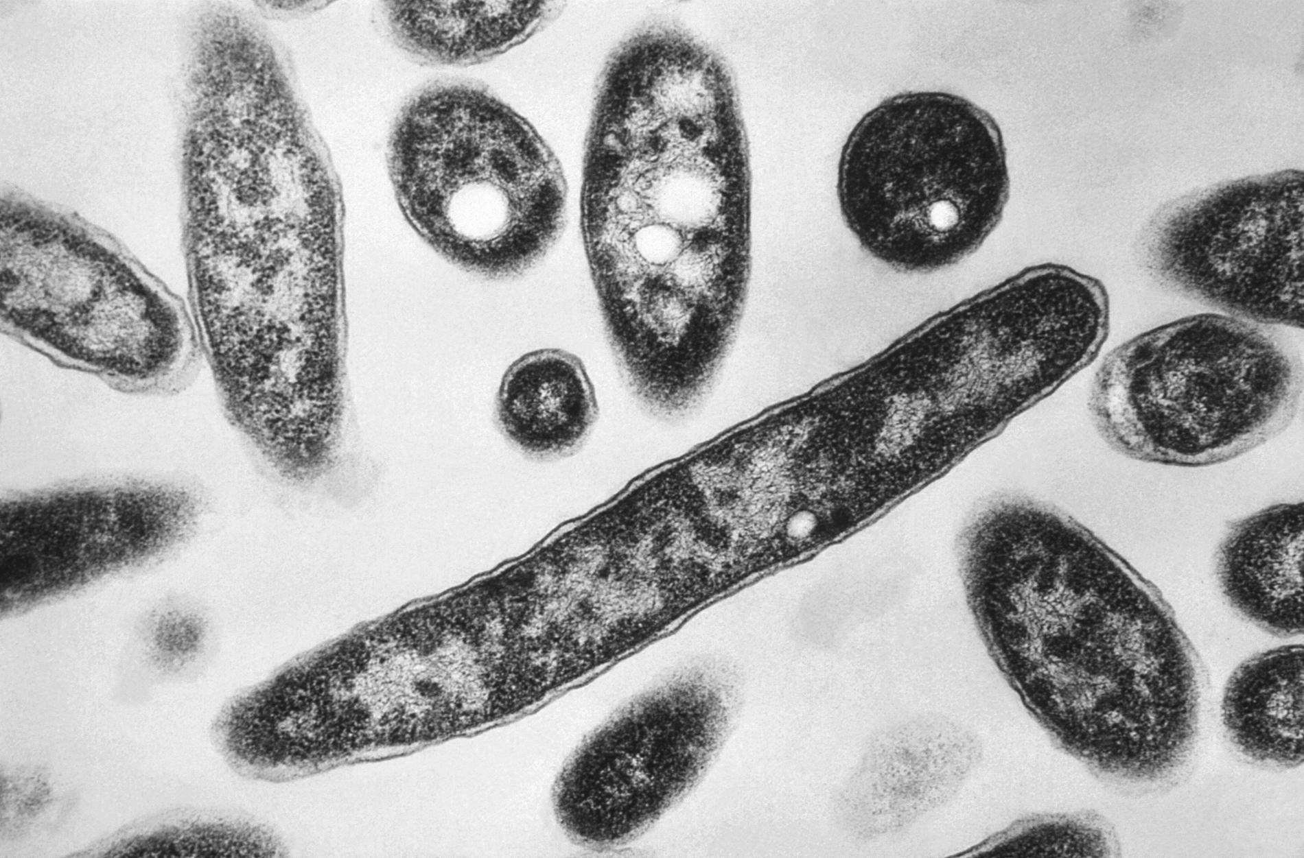 Legionella pneumophila bakterie. Sedd i mikroskop. 