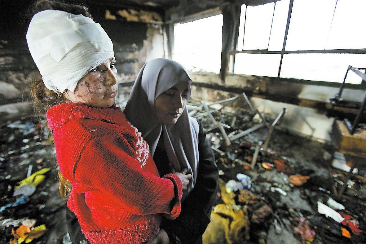 gaza 2009 Fatma, 8, blev enligt hennes mamma Azza bränd av vit fosfor i skolan.