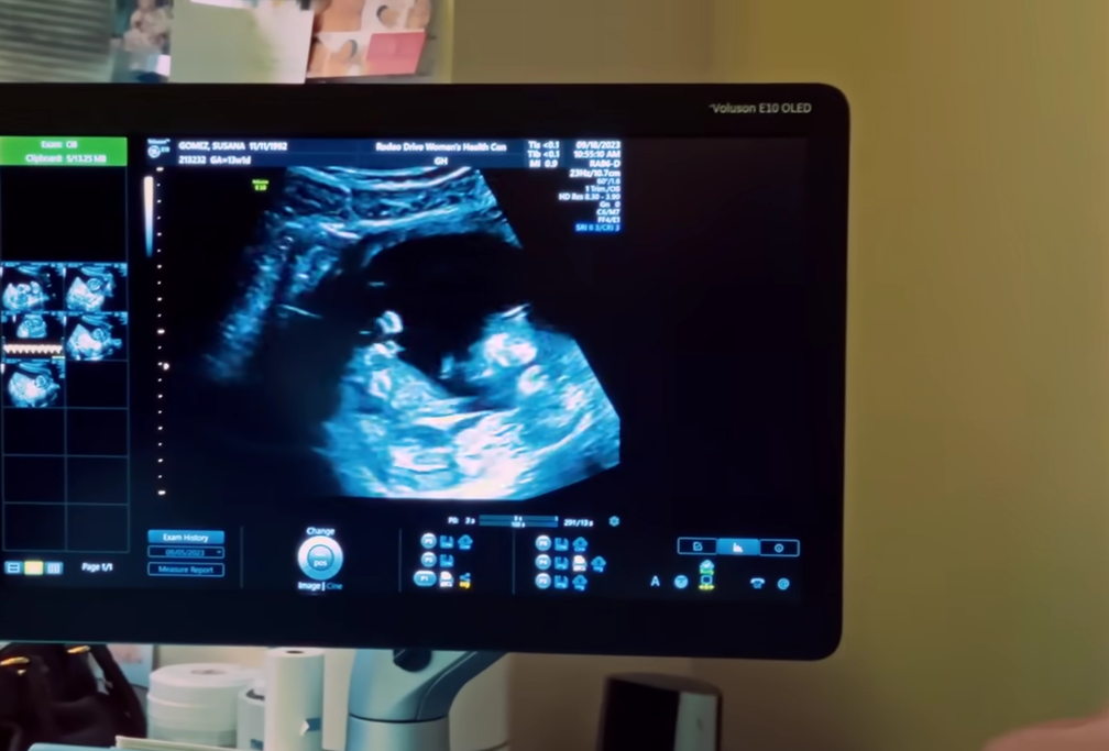I videon syns bilder på ultraljudet.