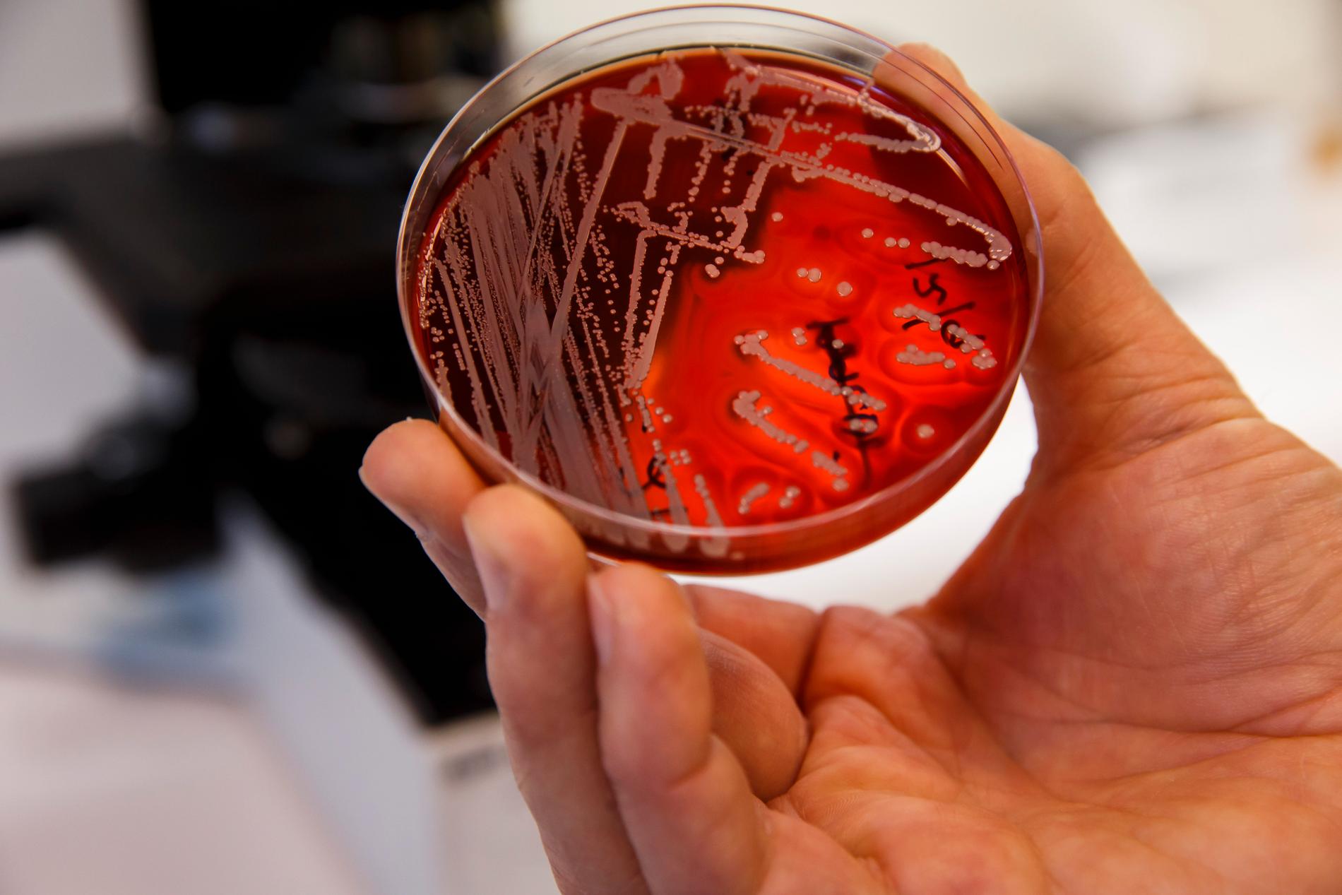 Utvecklingen med resistenta bakterier som ingen antibiotika biter på ses som ett hot mot den moderna sjukvården. Arkivbild.