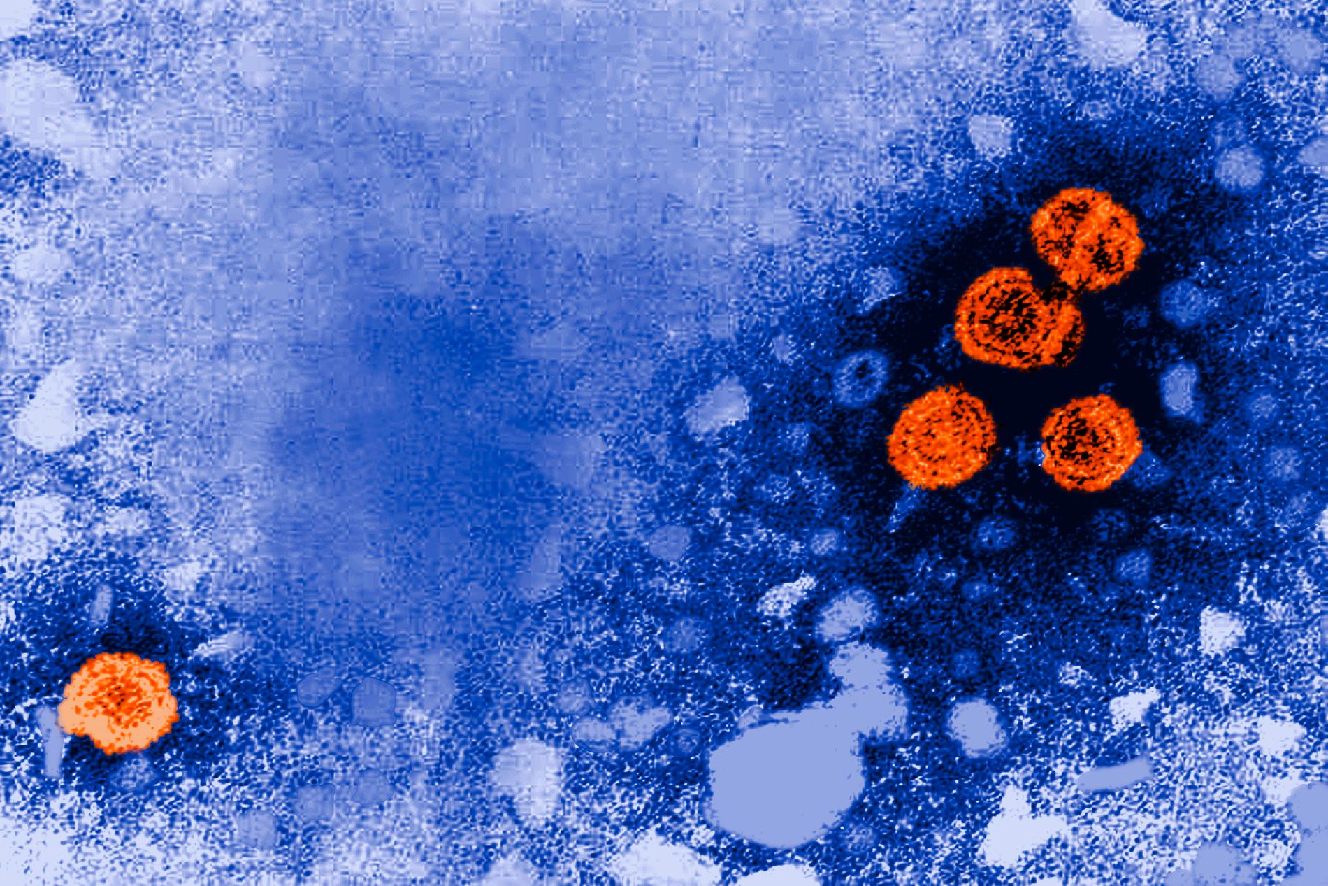 En bild tagen med elektronmikroskop visar hepatit B-viruset (orange), som orsakar en inflammation i levern.