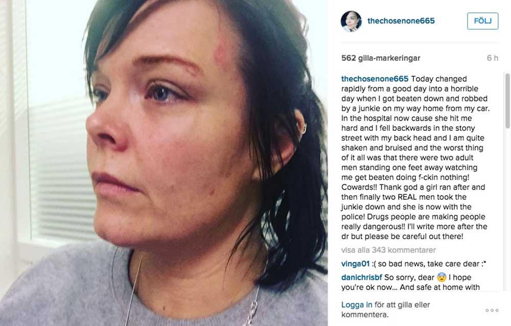 Anette Olzon skriver om överfallet på sitt Instagram.