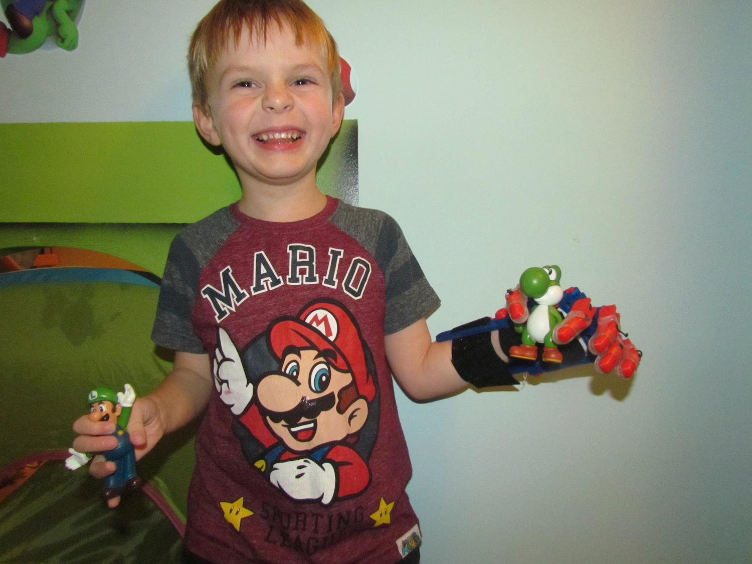 Antoni med sin Super Mario-gubbe Äntligen! Så här glad blir man när man är 6 år, saknar en hand, men precis fått en 3D-protes och för första gången kan greppa en leksak i varje hand. Antoni Rudd i Polen.