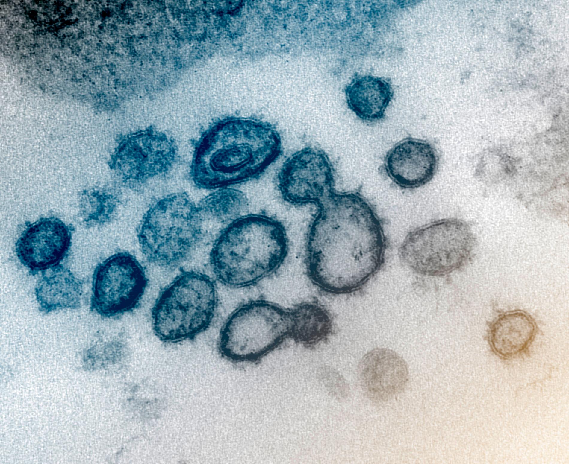 Coronaviruset sars-cov-2 fångat under mikroskop. Samhällets beredskap och Sveriges insatser mot smittospridningen hänger på att vi håller ihop. 
