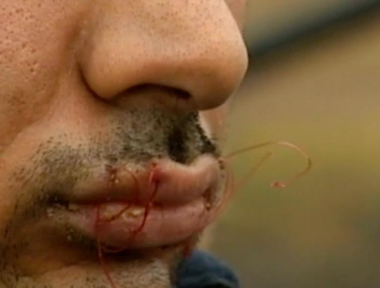 När beslutet från Migrationsverket kom valde Hamid att sy igen sin mun.