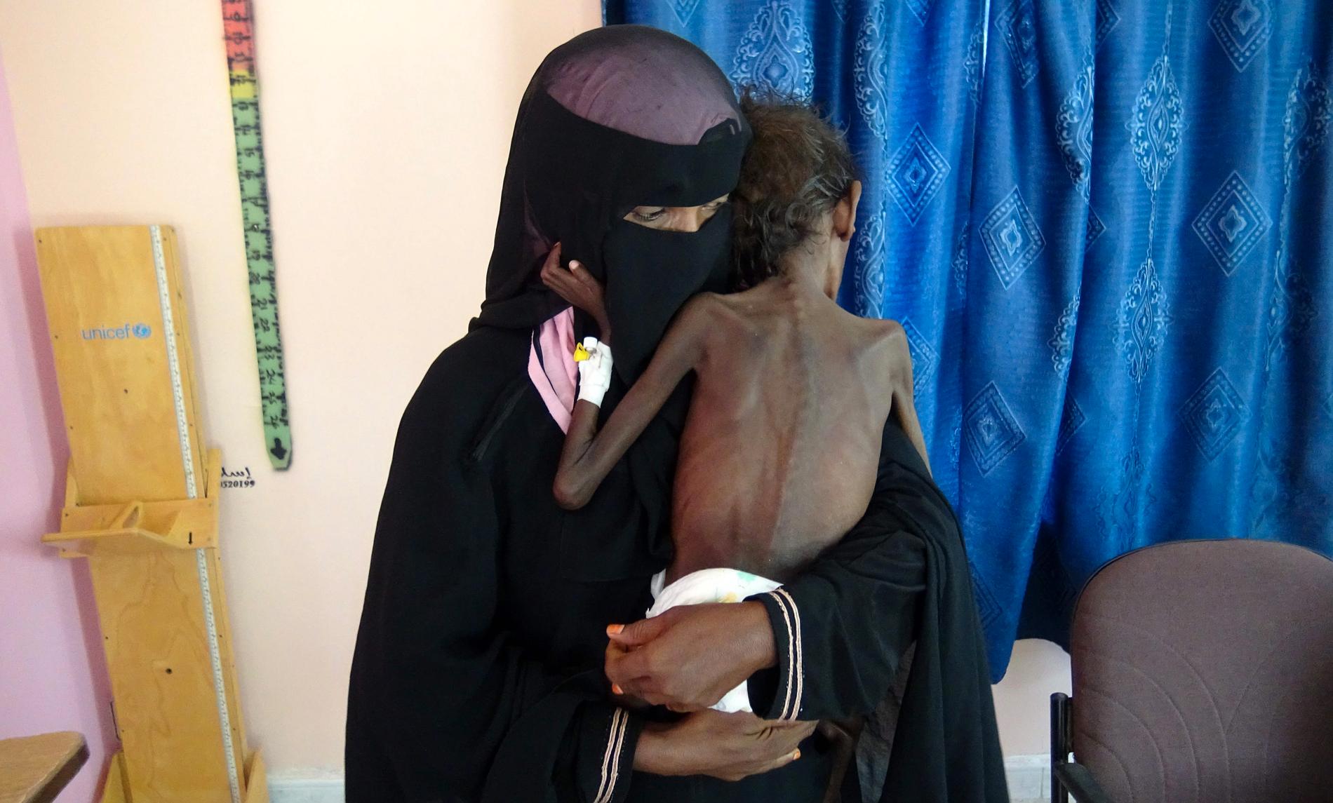 En kvinna håller sin femåriga son på ett sjukhus i hamnstaden al-Hudaydah i västra Jemen. Pojken lider av allvarlig undernäring och väger bara fem kilo. Arkivbild.