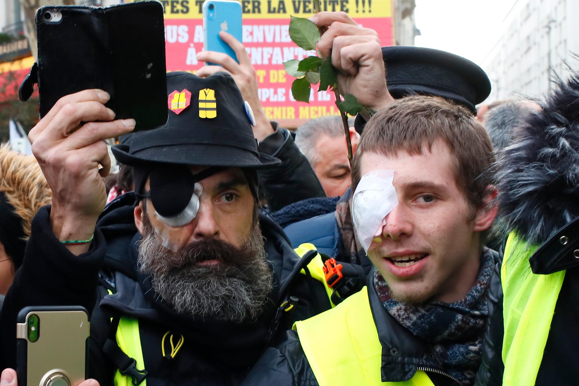 Skadade Jérôme Rodrigues, en av Gula västarnas frontfigur, tillsammans med en demonstrant. 
