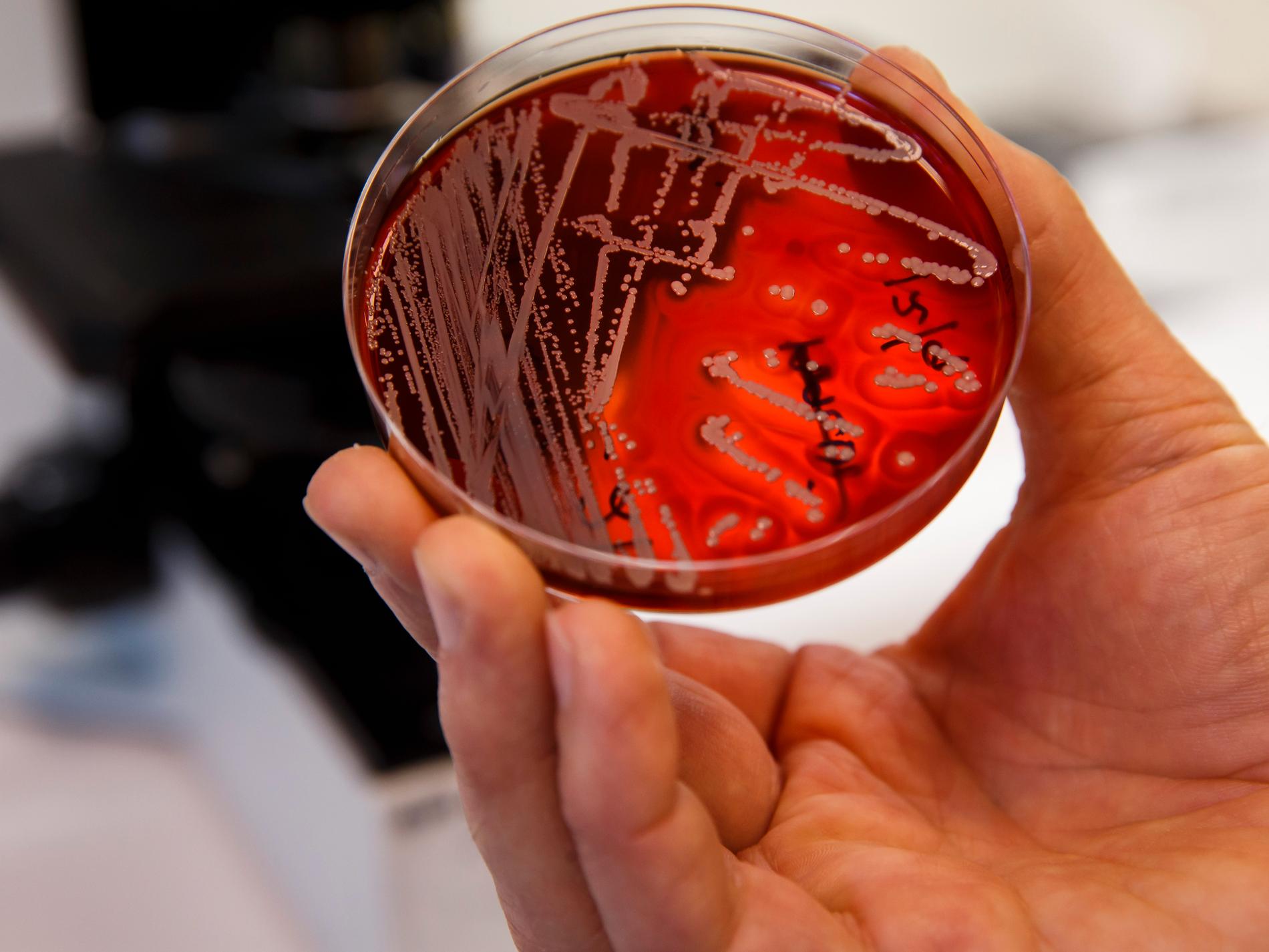 FN-rapport: Så kan resistenta bakterier stoppas