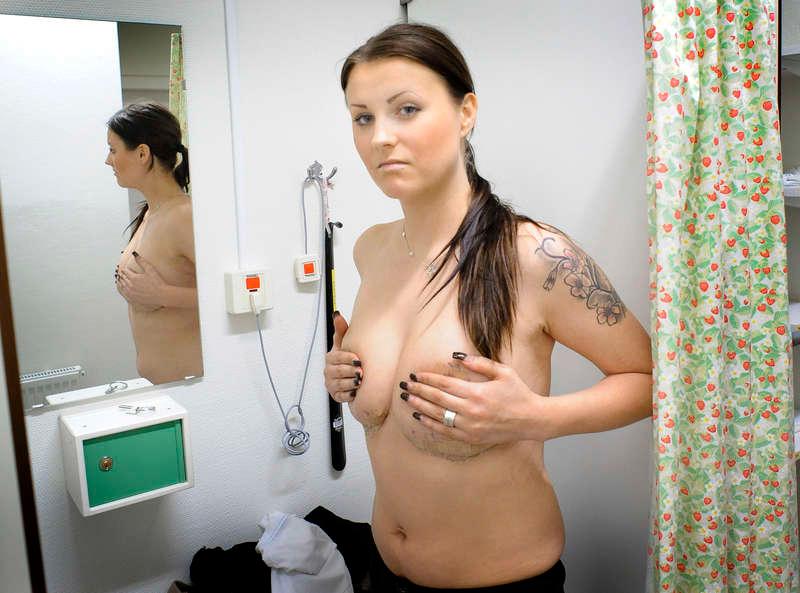 KÄNNER SIG LURAD Fia Ahlsén, 28, förstorade sina bröst 2008, hon fick då livstidsgaranti på PIP-implantaten. Men Fia fick direkt problem med det vänstra bröstet, det läkte inte och var rann ur såret. Hon opererade bort implantaten och gjorde i stället ett bröstlyft som kostade henne 38 500 kronor. ”Så nu sitter jag med dubbla lån, jag känner mig så jävla lurad ”, säger hon.
