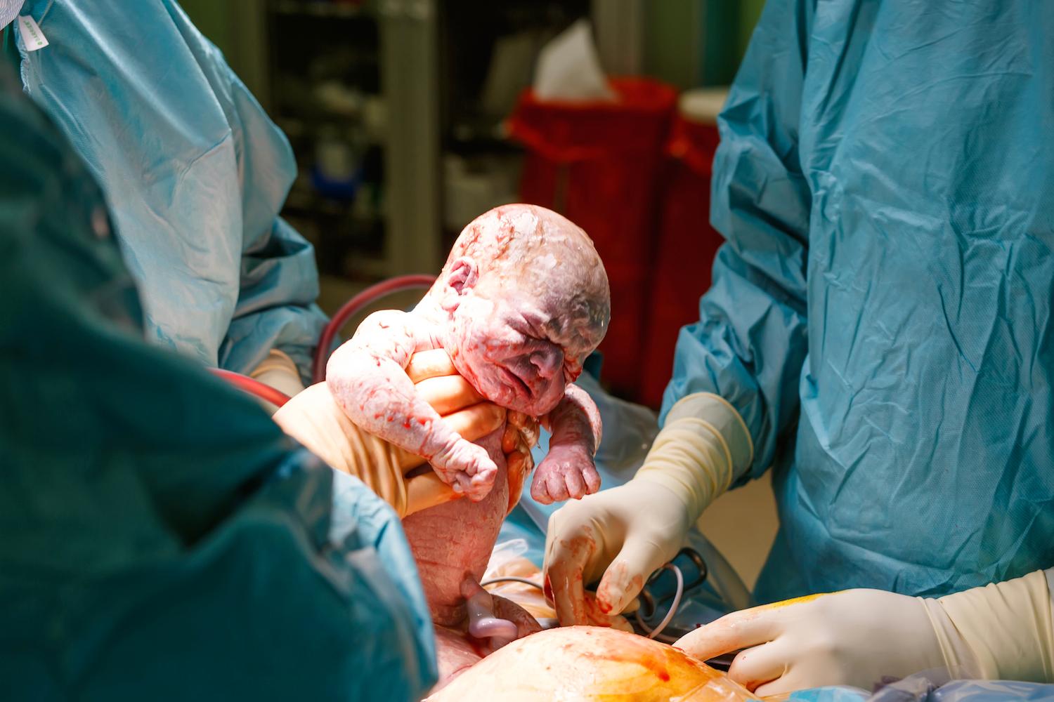 Hos vaginala omföderskor har igångsättning av förlossningen betydligt större chans att lyckas än för förstföderskor och man lyckas i cirka 95 procent av fallen.