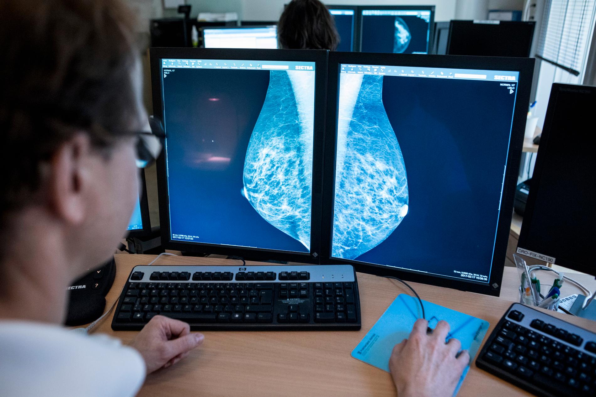 I stället för att låta en läkare titta på röntgenbilder av bröst, kan konstgjord intelligens göra samma sak fast både snabbare och bättre.