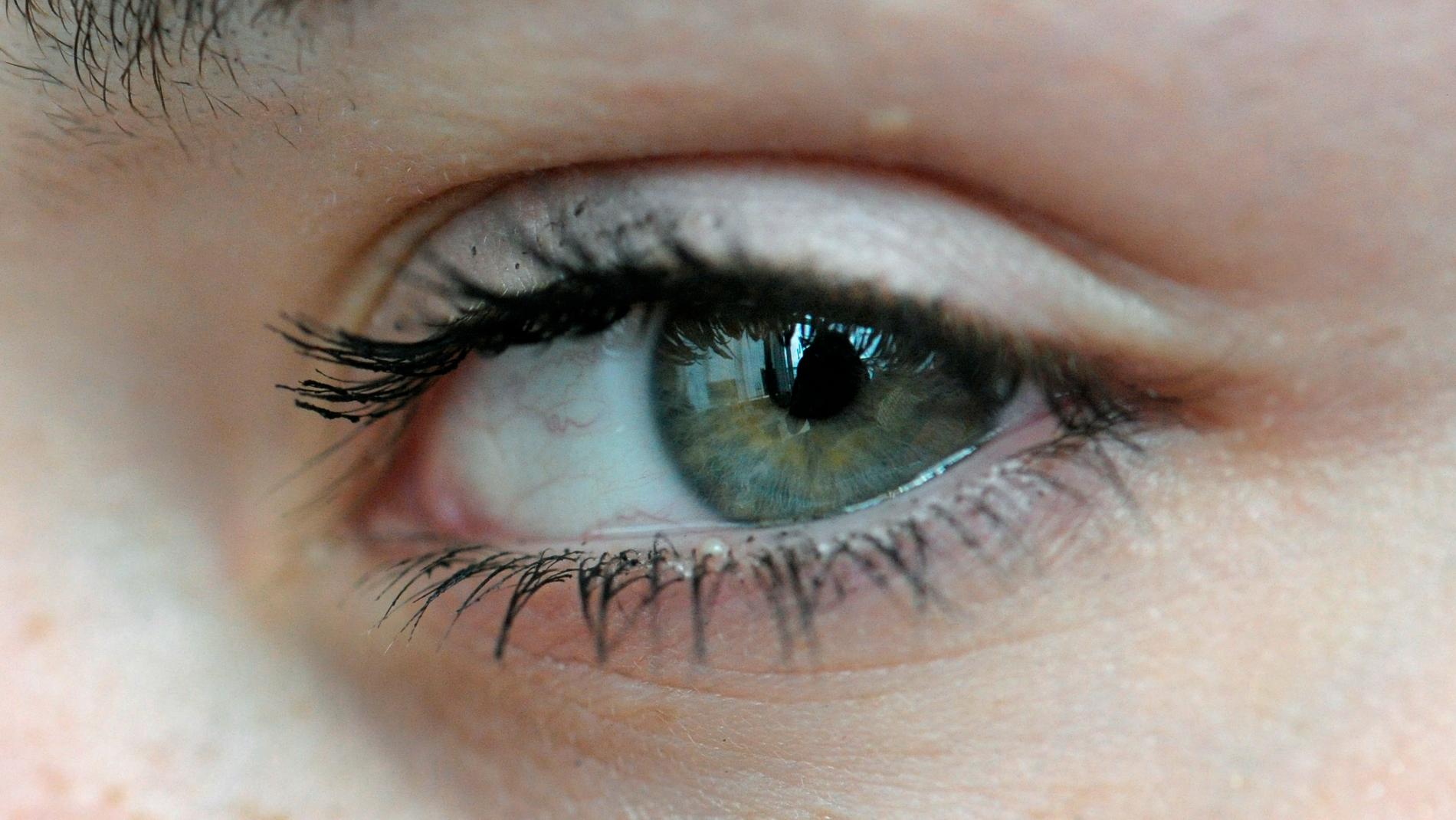För första gången har forskare försökt behandla åldersförändringar i gula fläcken, en vanlig ögonsjukdom, med hjälp av genterapi.