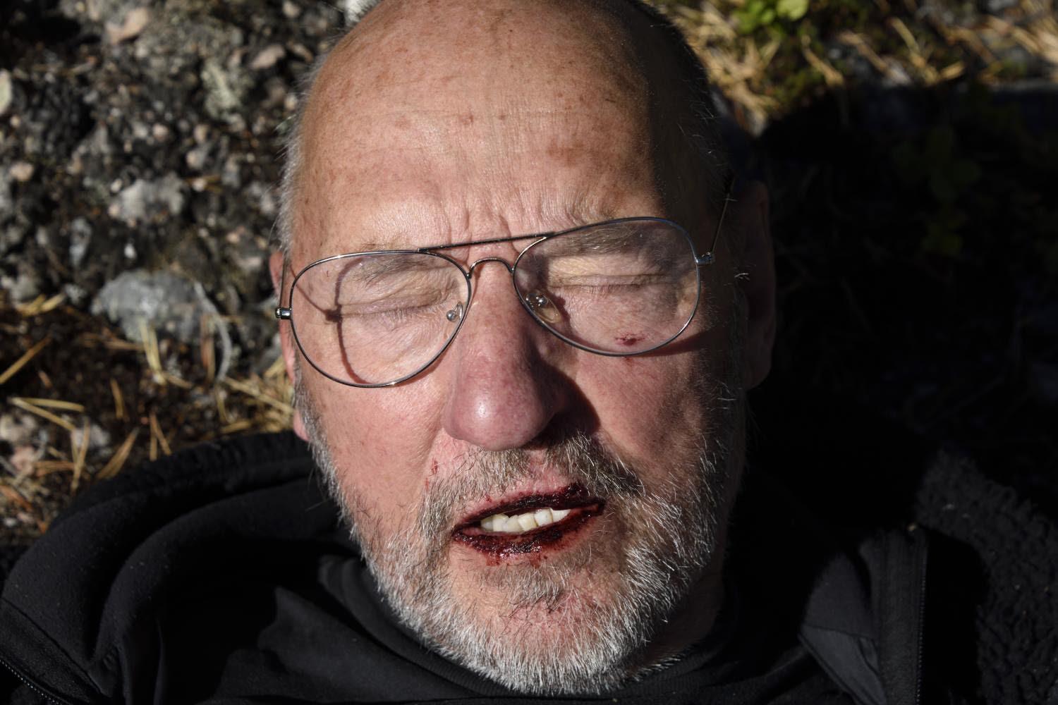 Kjell Rudolphi, 75, blev slagen i ansiktet samtidigt som flera män sparkade på hans kropp.