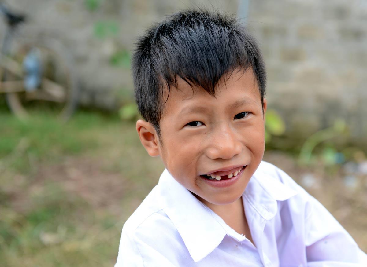 Trung föddes med ett hål i skiljeväggen mellan hjärtkamrarna.