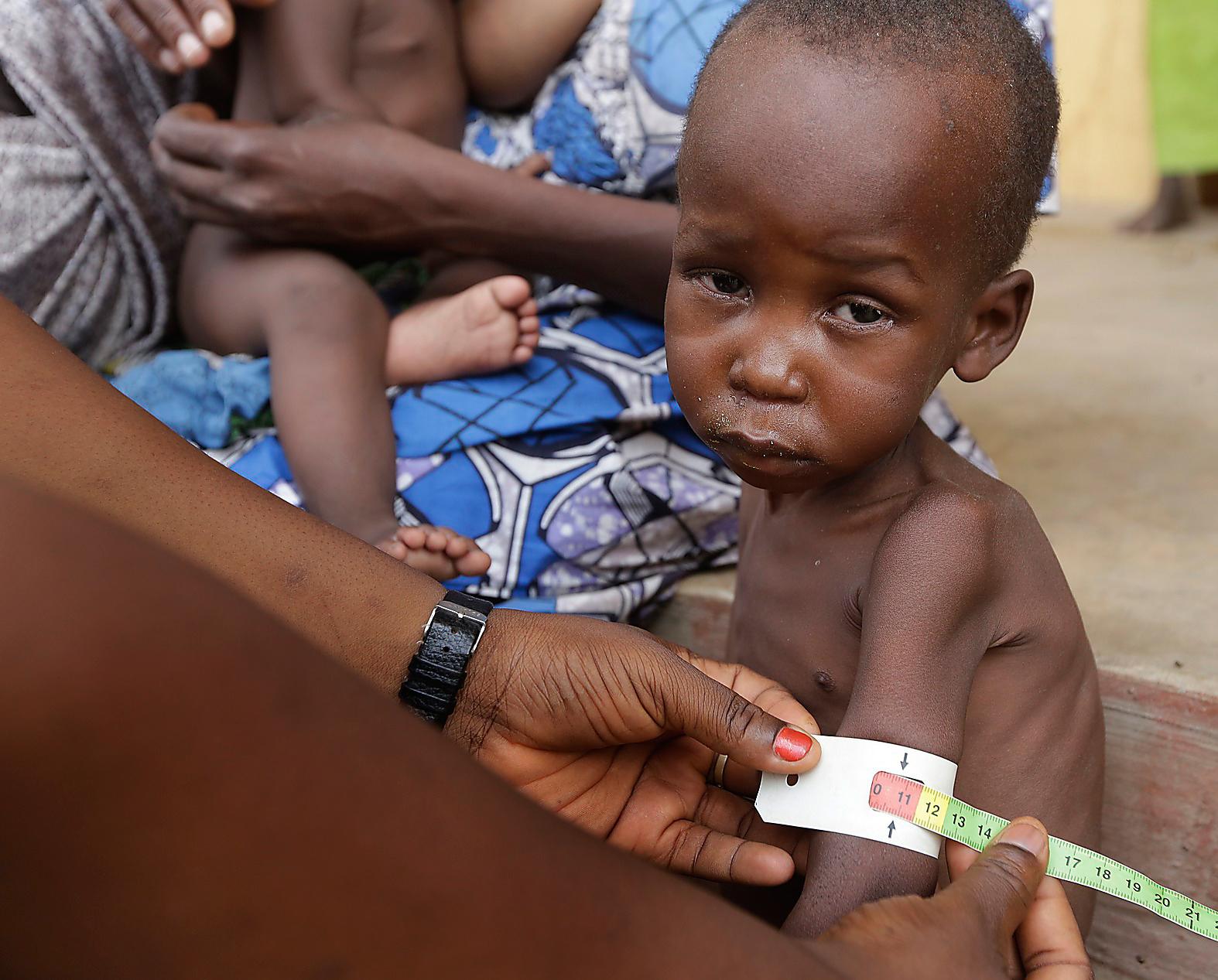 Deras hunger – vår skuld Undernärda barn får hjälp i ett flyktingläger i Yola, Nigeria. En knapp miljard människor lever på svältgränsen trots att det produceras tillräckligt med mat för att mätta fem miljarder fler människor än det finns på jorden. Foto: AP