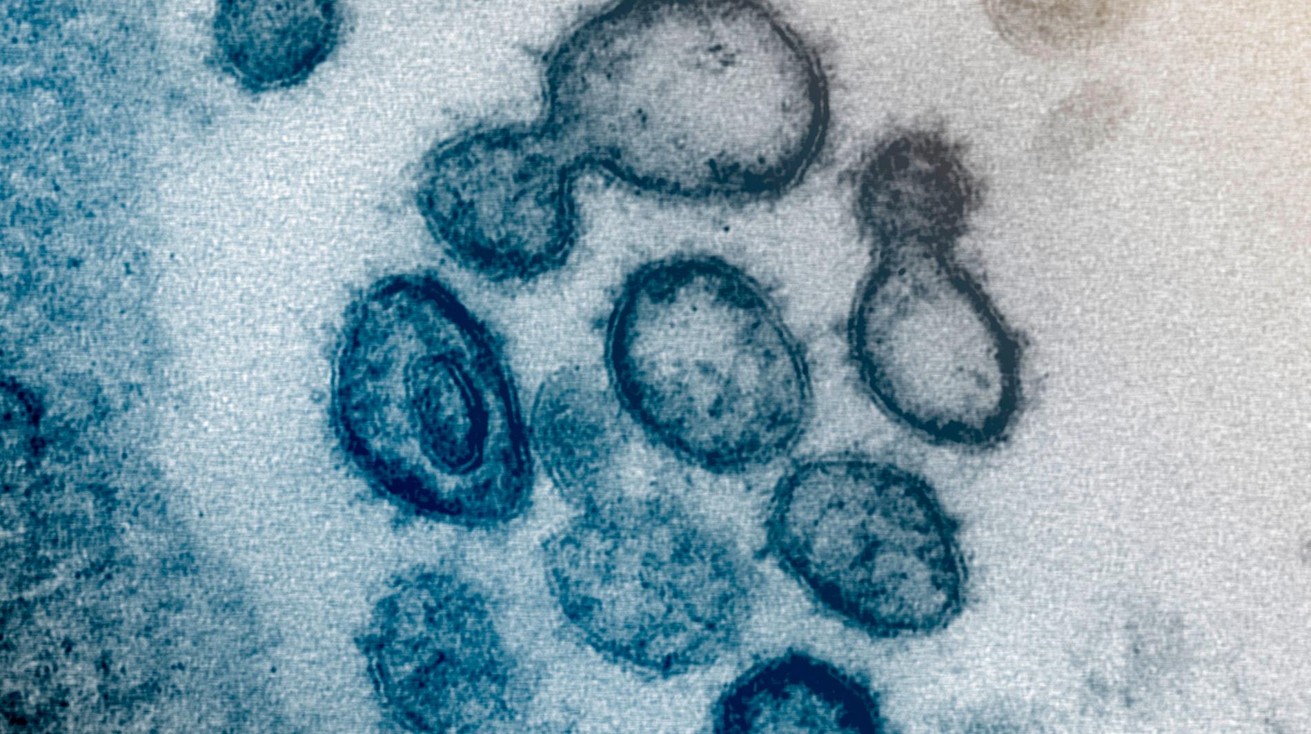 Foto av coronaviruset i mikroskop. 