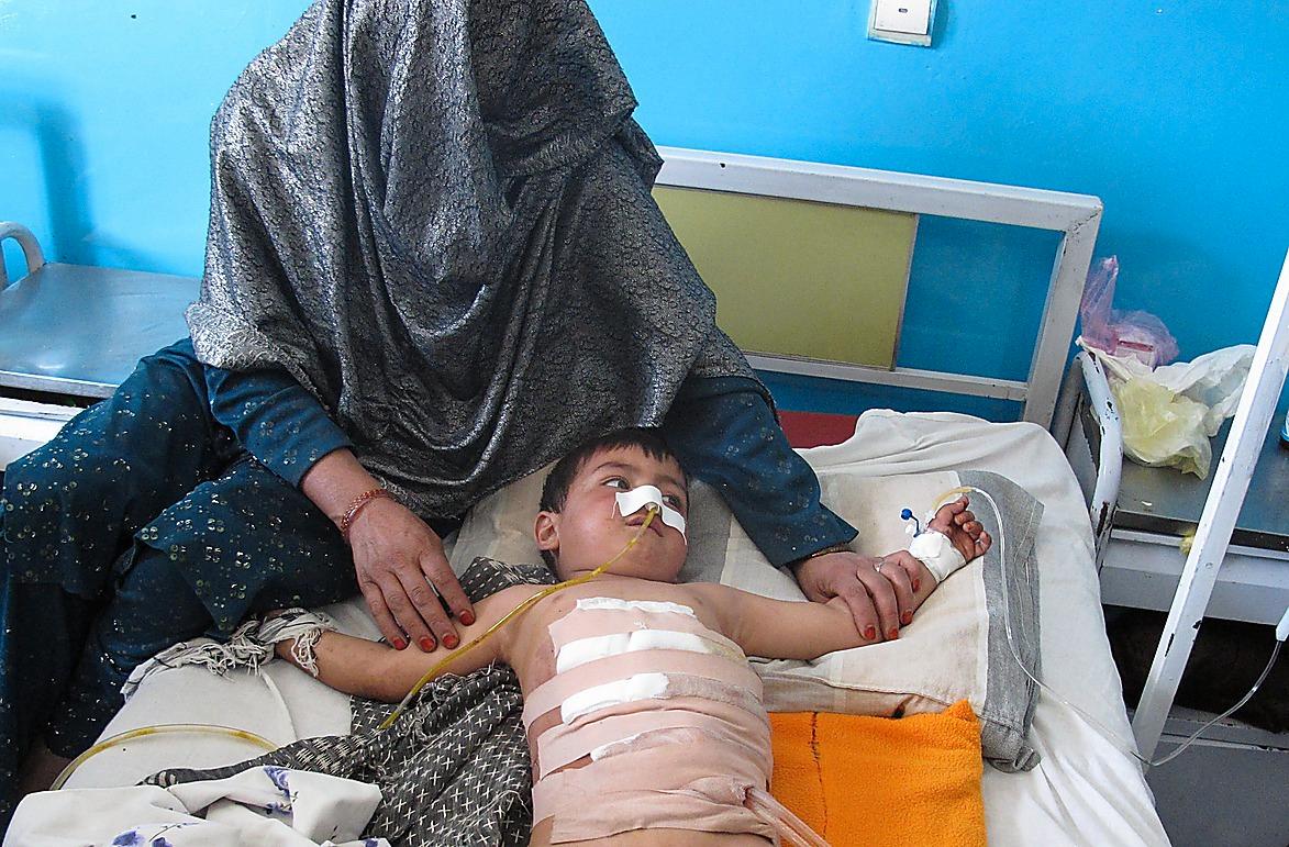 Skadad En pojke vårdas för bukskador på Afghanistankommitténs sjukhus i Maidan Shahr. Han var ute och lekte i den oroliga Wardakprovinsen då han och hans syskon hamnade i korseld mellan Isaf-styrkor och talibaner.