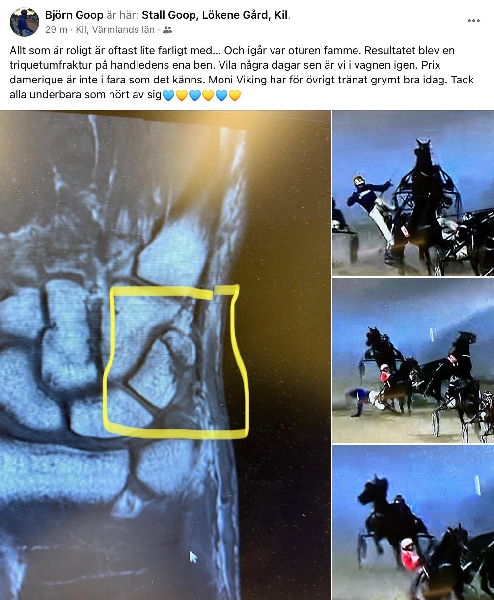 Björn Goop visar upp röntgenbilden på Facebook.