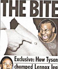 Engelska The Sun publicerar bilden som visar skadan på Lennox Lewis lår.