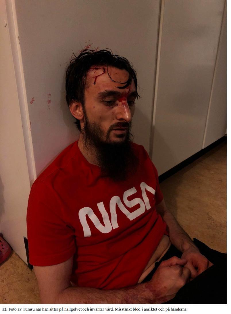 Tjetjenske bloggaren och regimkritikern Tumsu Abdurakhmanov, 34. Bilden togs direkt efter att han avvärjt attacken och övermannat den utsände mördaren. 