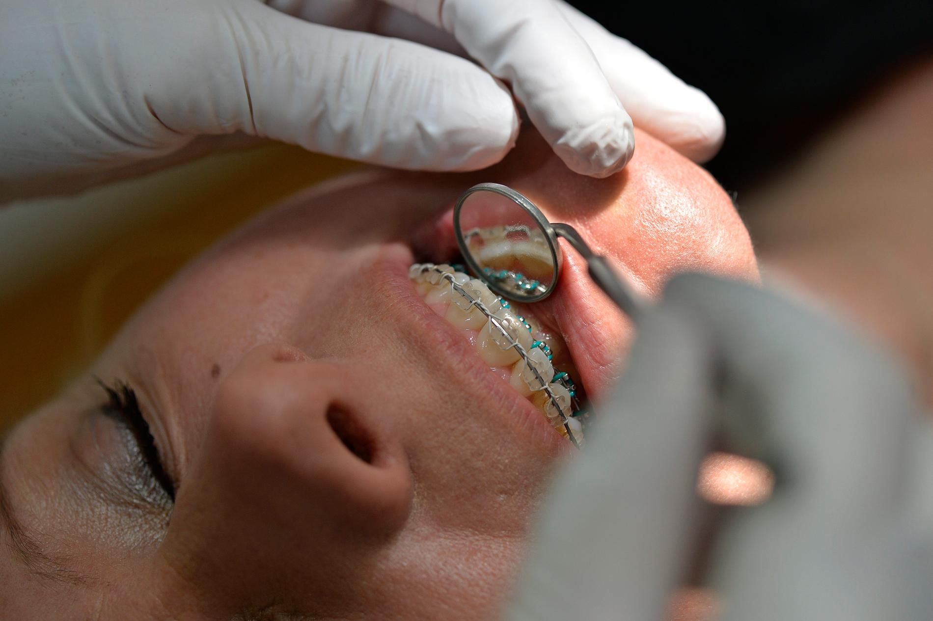 Lova en reform som gör att tänderna ingår i den allmänna sjukförsäkringen, skriver Åsa Linderborg. 