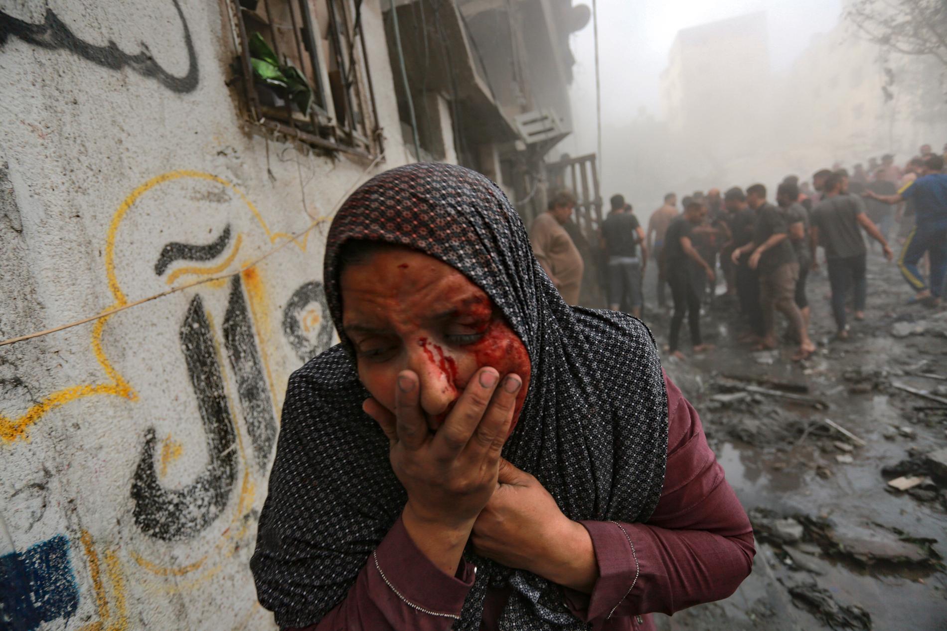 En palestinsk kvinna som skadats i Israels luftangrepp mot Gaza, den 23 oktober, 2023.