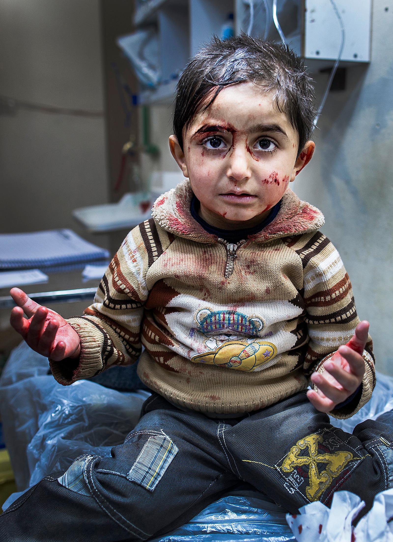 barn i skottlinjen Den lilla pojken som träffats av bombsplitter får vård på ett hemligt fältsjukhus i Yabrud. Hans pappa tog honom till sjukhuset. Det här är en av bilderna som fotografen Niclas Hammarström fick med sig hem från Syrien.