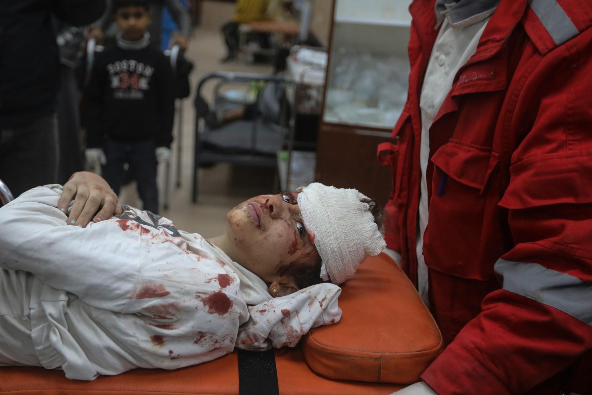 Ett skadat barn som förts till ett sjukhus i Gaza efter israeliska bombningar.
