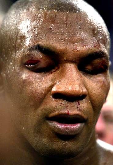 Tyson fick ofantligt med stryk från Lewis och blödde från bägge ögonbrynen och näsan.