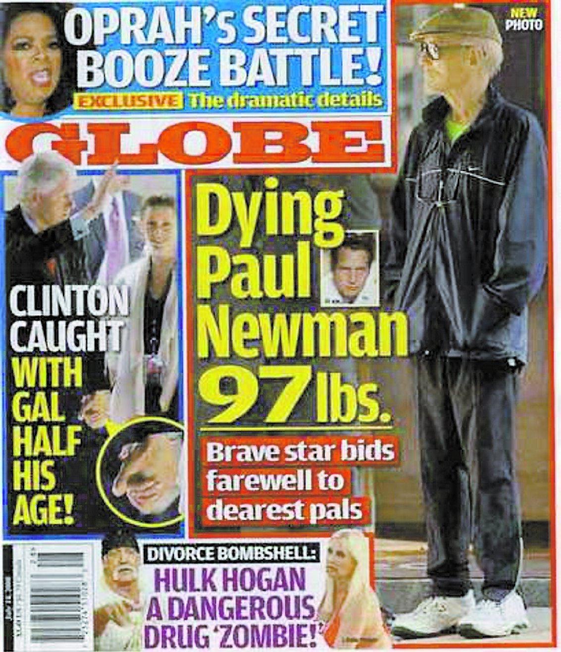 tärd av cancer Bilder på Newman i tidningen Globe.