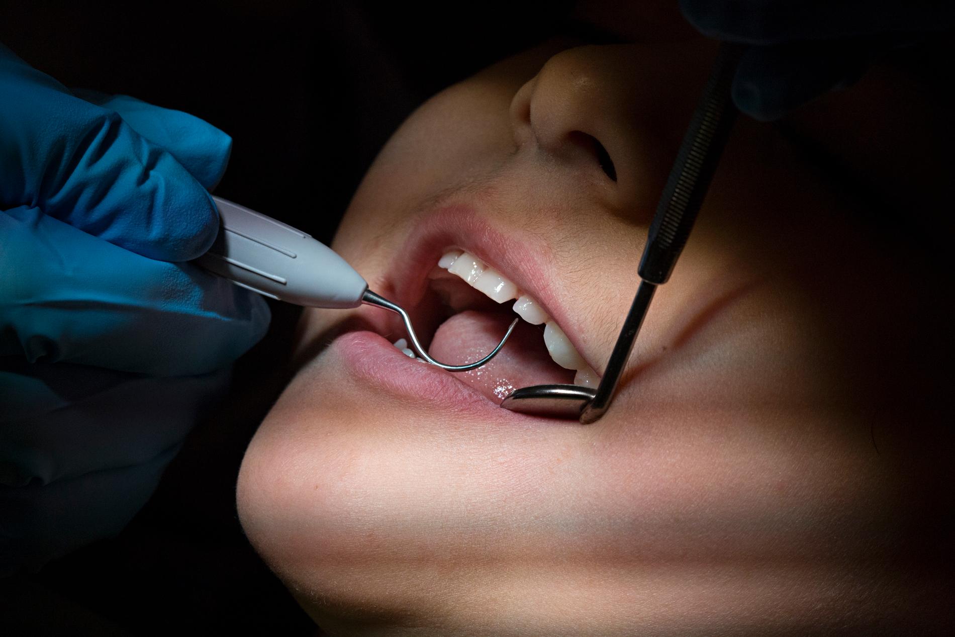 Ungefär nio av tio har förtroende för sin tandläkare, något fler inom den privata tandvården jämfört med Folktandvården. Arkivbild.