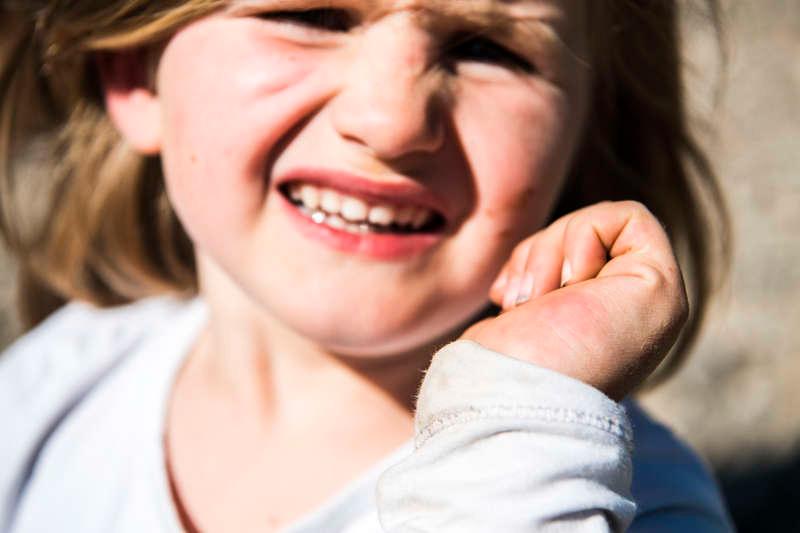 Cornelia, 4, visar sitt myggbett på handen.