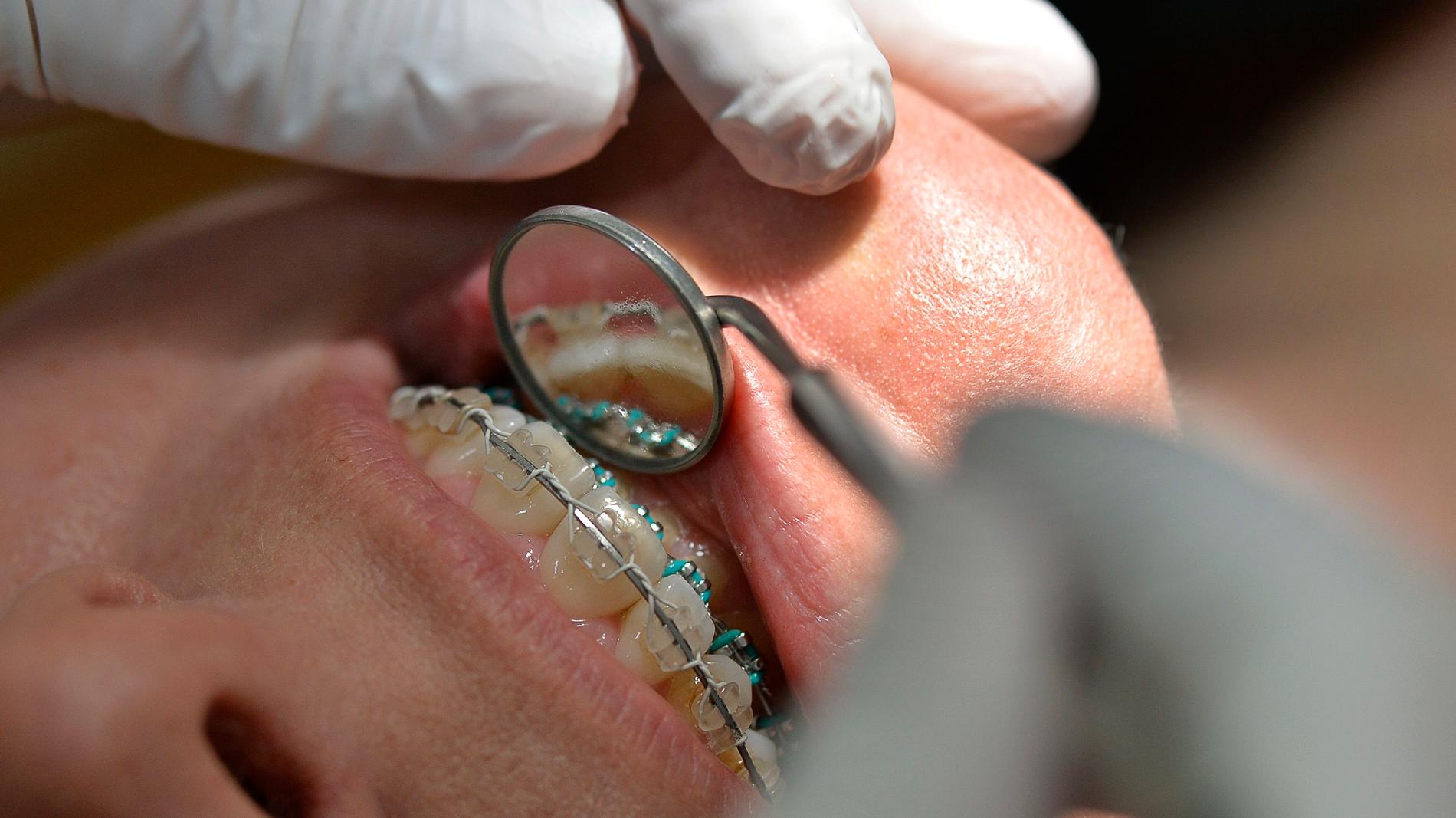 Den tandläkare i Västsverige som har anmälts för nästan 200 felbehandlingar och skador delges nu misstanke om brott. Arkivbild.