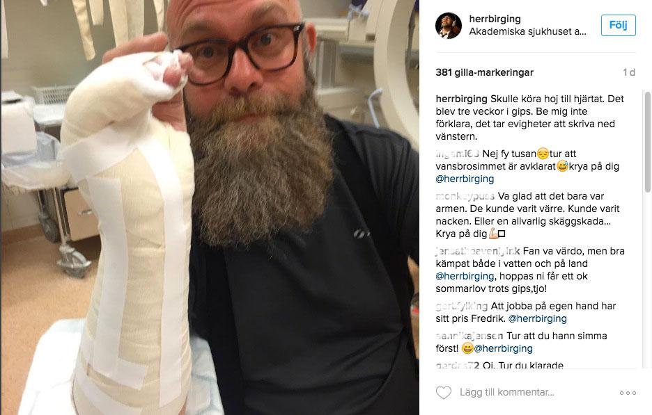 Fredrik Birging visar upp sin gipsade arm på Instagram.