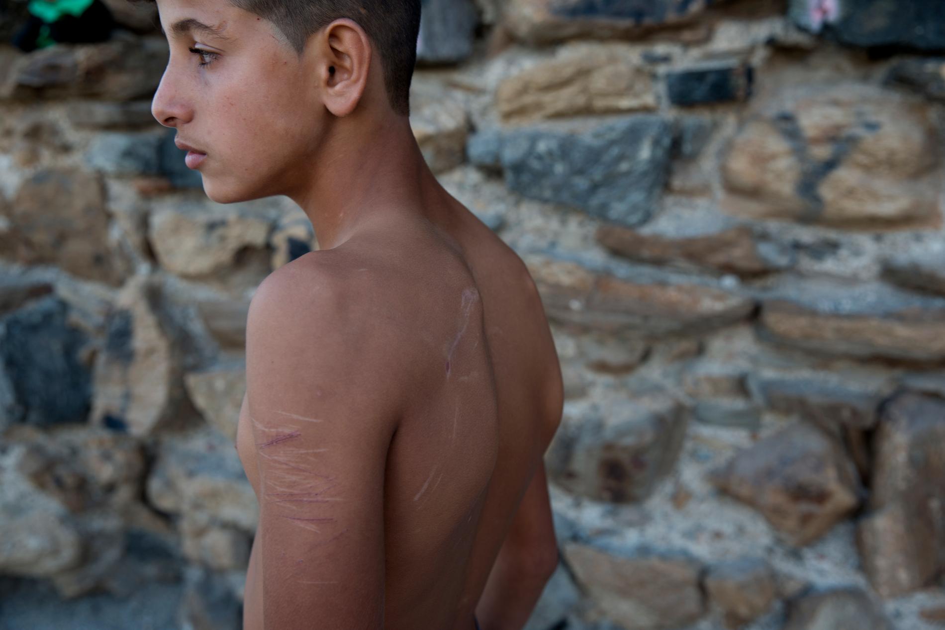 Gatubarn i Marocko som försöker att ta sig till Europa. Yassin, 14 sover på stranden. Hans kropp har många ärr efter slagsmål och knivskärningar