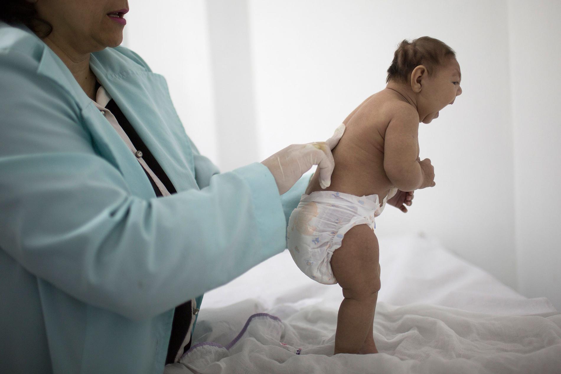 Tre månader gamla Lara, ett av hundratals barn som fötts med mikrocefali, undersöks av neurologer  på ett sjukhus i Campina Grande, Brasilien, i februari.