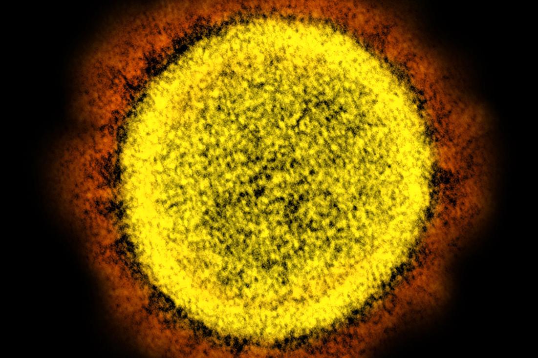 Coronaviruset, sett i mikroskop.