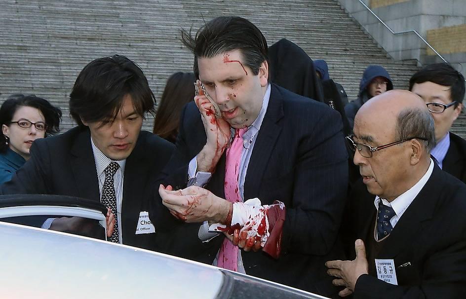 Blödde kraftigtDen amerikanske ambassadören Mark Lippert skars i ansiktet när en man attackerade honom med rakblad i Seoul.