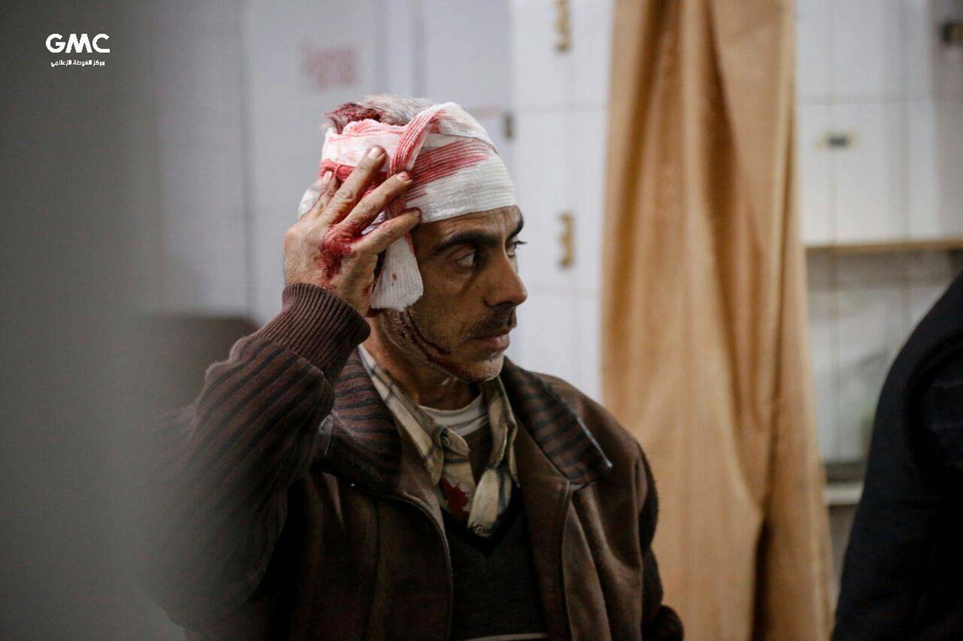 En man väntar på behandling på en provisorisk klinik i östra Ghouta i Syrien. Bilden kommer från det regimkritiska aktivistnätverket Ghouta Media Center och distribueras av nyhetsbyrån AP.