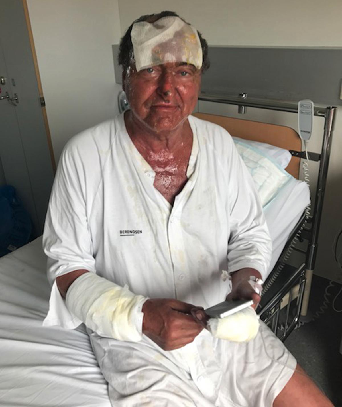 Uppfinnaren Anders Olsson, 71, skulle testa en ny apparat - som exploderade och orsakade storbrand.