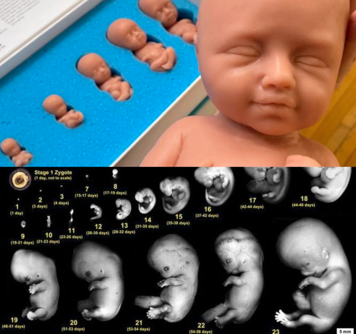 Organisationen Kvinnor för livet hävdar att foster ser ut som en ”liten människa” redan i fjärde veckan. Det stämmer inte.