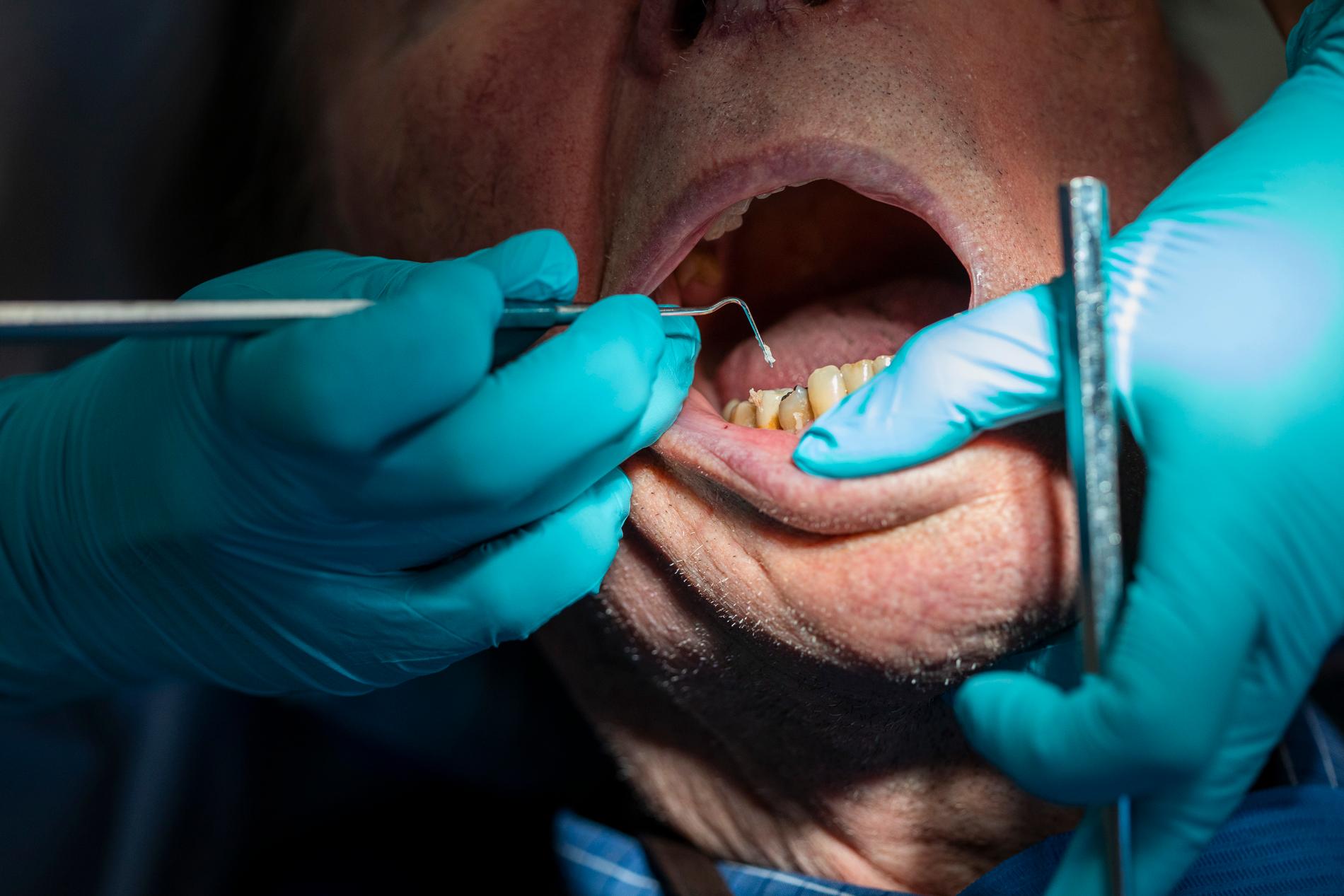 Norska tandläkare ska ge vaccin istället för bedövning. 