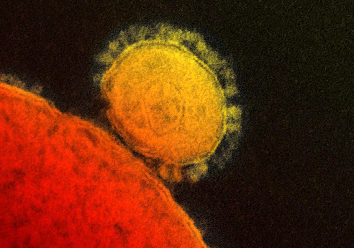 Coronaviruset sett i mikroskop.