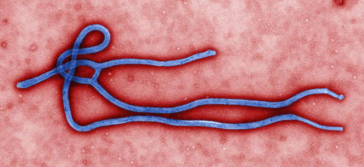 Ebolaviruset.