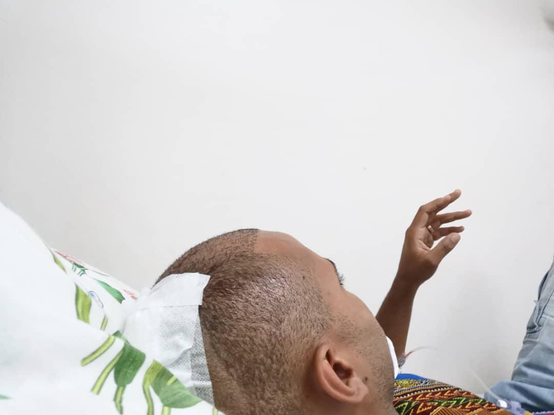 Föll ihop i badrummet. Mohombi har tvingats sy nio stygn i bakhuvudet och sex stygn på hakan.
