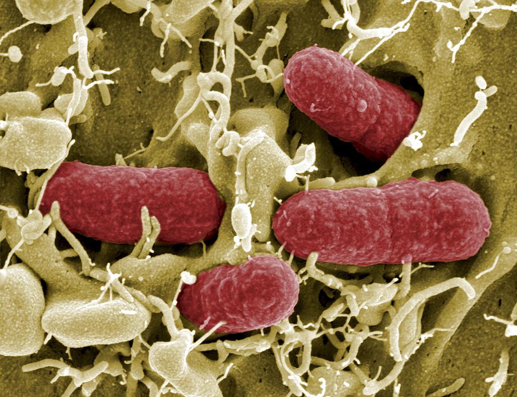 EHEC-bakterier. 