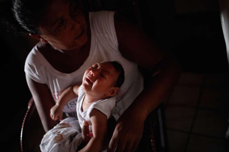 Brasilianska Alice, tre månader, föddes med en microcefali.